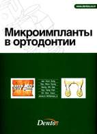 Книга "Микроимланты в ортодонтии"